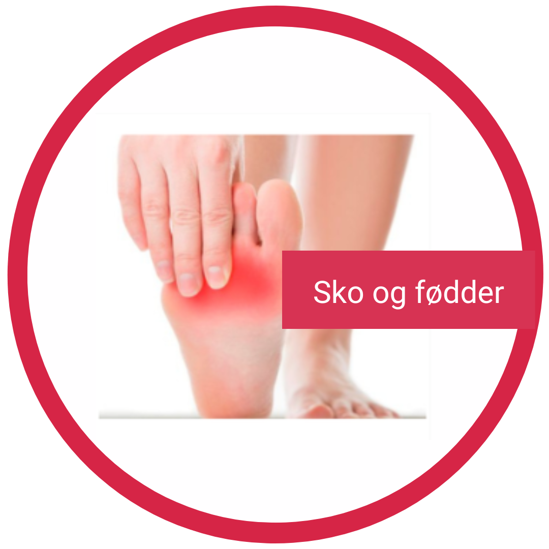 Illustration af fodproblemer og sko, der linker til viden om sko og fødder.